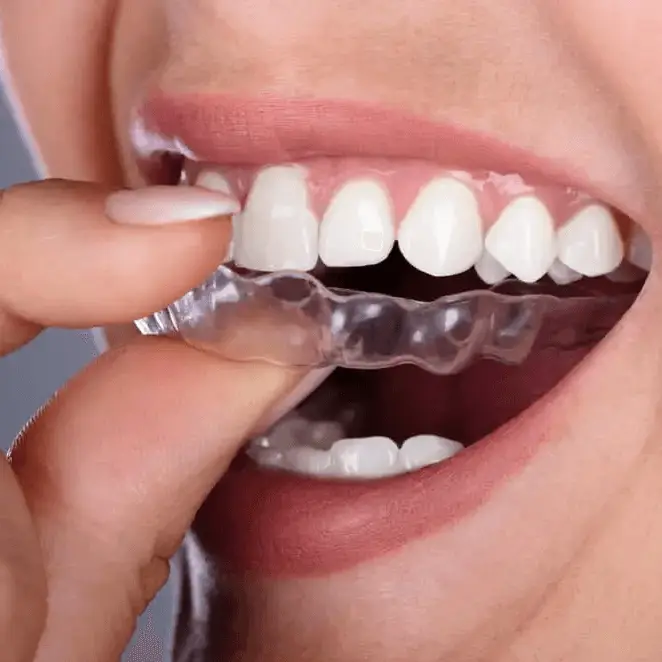 Dentista cerca de mí, dentista cerca de mí, mejor dentista de miami, mejor dentista de miami, pizza cerca de mí, chino cerca de mí, comida cerca de mí, dentista de corona en miami, dentista más barato en miami, dentista de tratamiento de conductos en miami, dentista de tratamiento de conductos en miami más barato